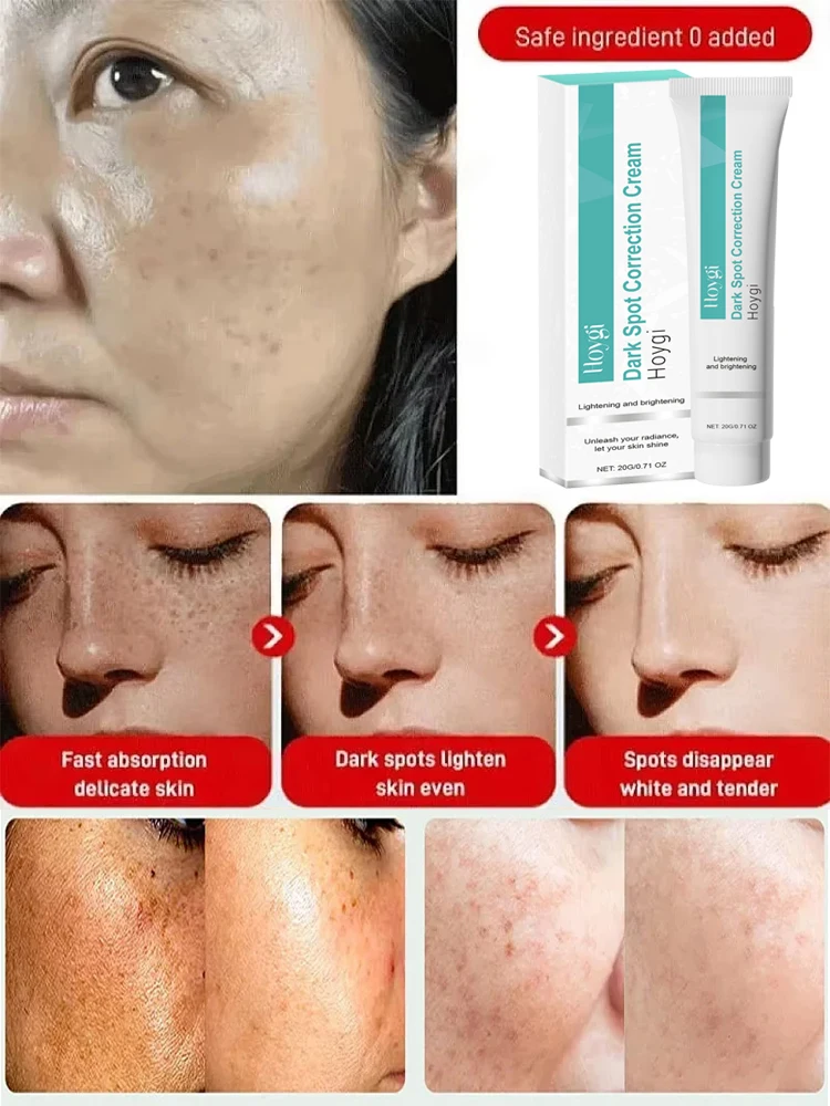 Mocny krem wybielający usuwają – Luxury Skincare Brands recenzja i cena