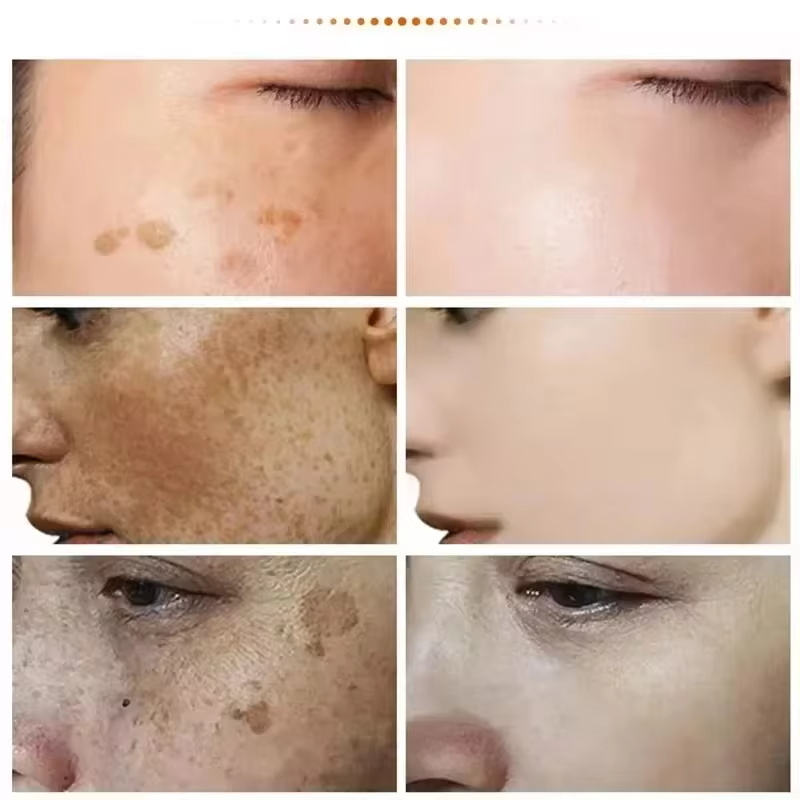 Mocny krem wybielający usuwają – Luxury Skincare Brands recenzja i cena