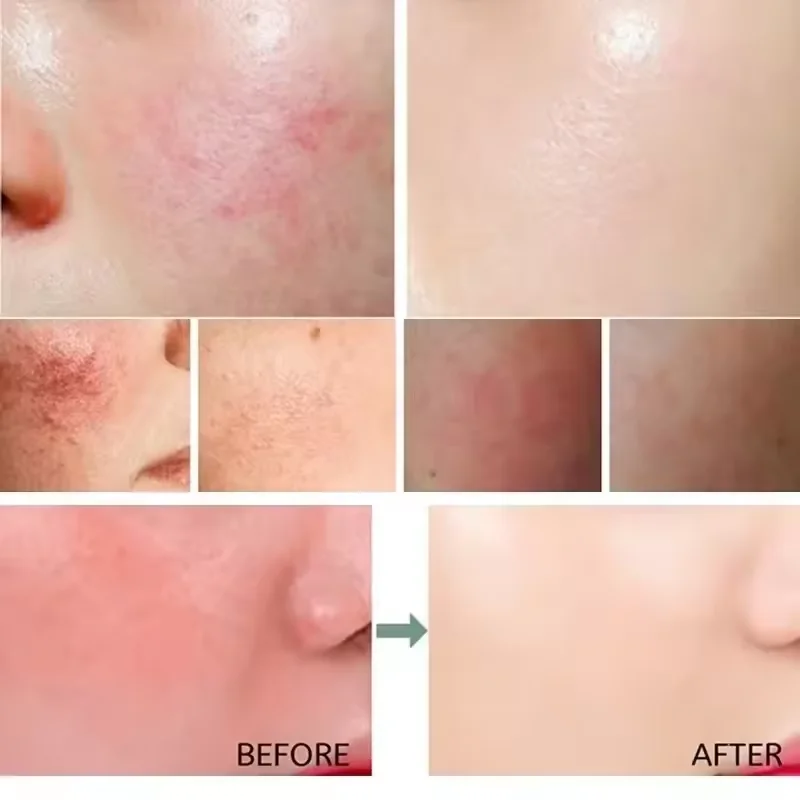 Krem na zaczerwienie skóry twa – Luxury Skincare Brands recenzja i cena