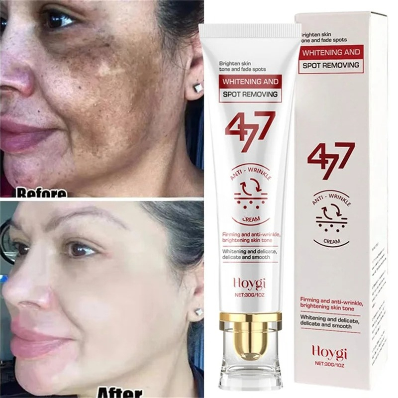 Skuteczny krem wybielający usu – Luxury Skincare Brands recenzja i cena