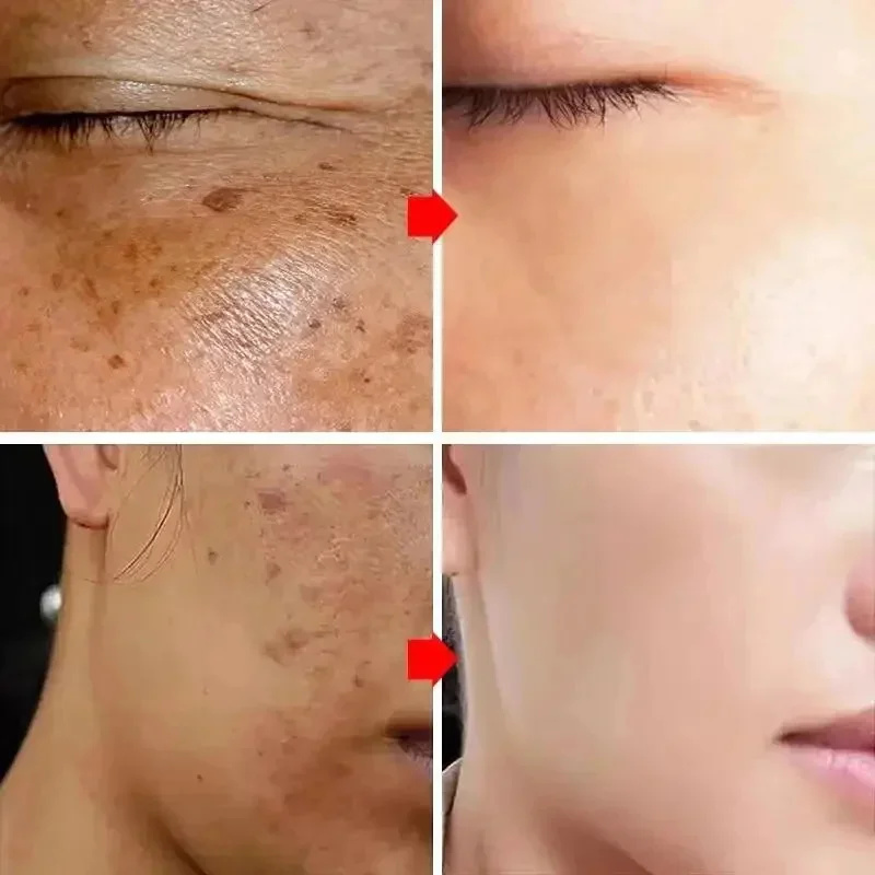 Skuteczny krem wybielający usu – Luxury Skincare Brands recenzja i cena